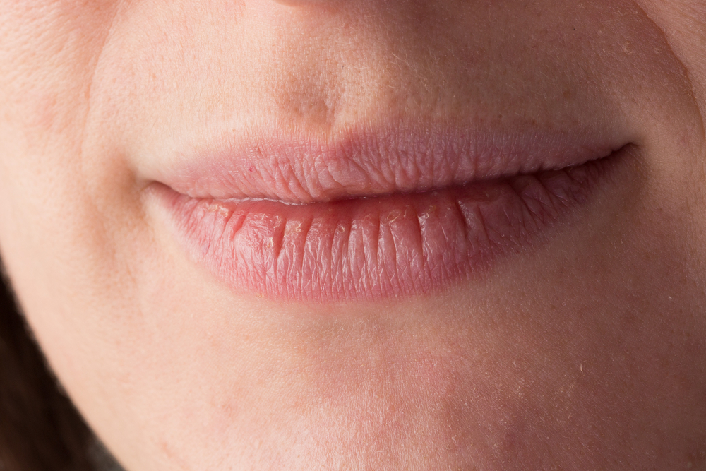 La boca seca podría ser manifestación de otras afecciones médicas. (Foto Prensa Libre: Shutterstock)