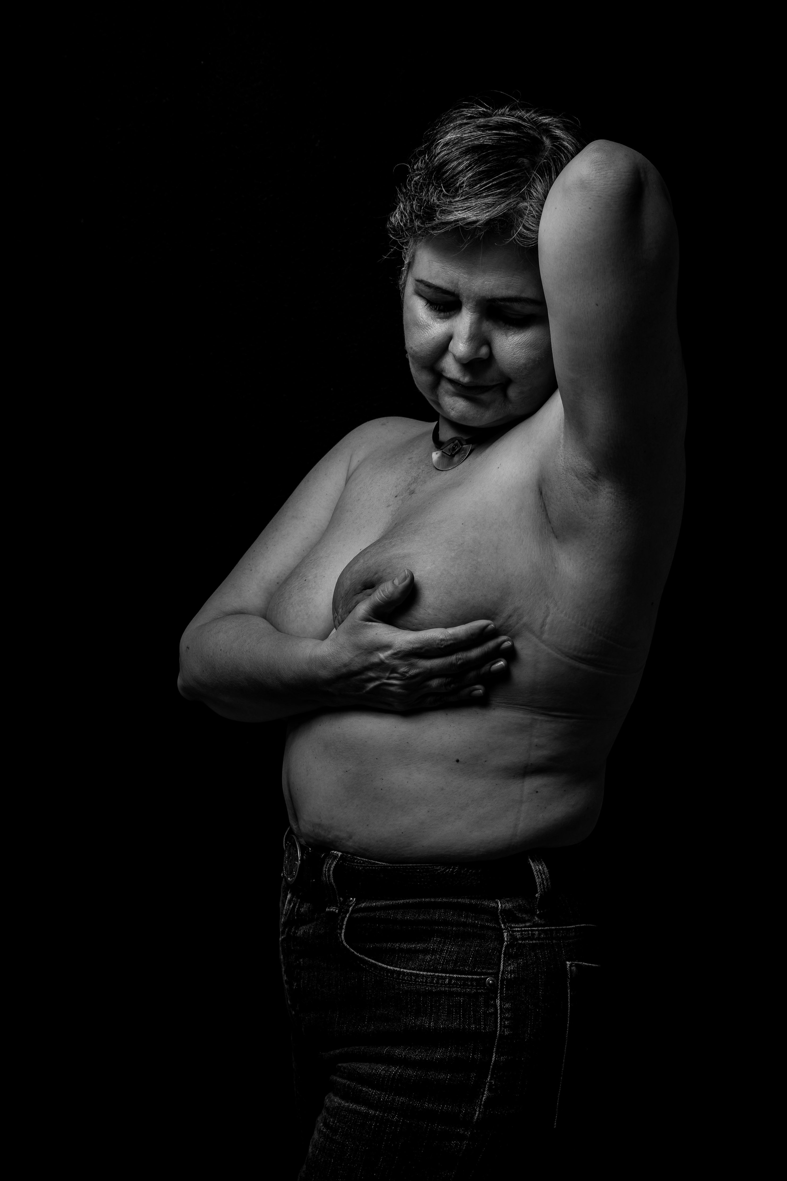 Estrella Rodríguez, mujer de 60 años, paciente oncológica diagnosticada en el año 2017, posa para un retrato. (Foto Prensa libre EFE)