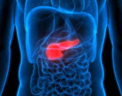 Cáncer de páncreas: la combinación de 2 fármacos que “mata de hambre” a las células cancerosas