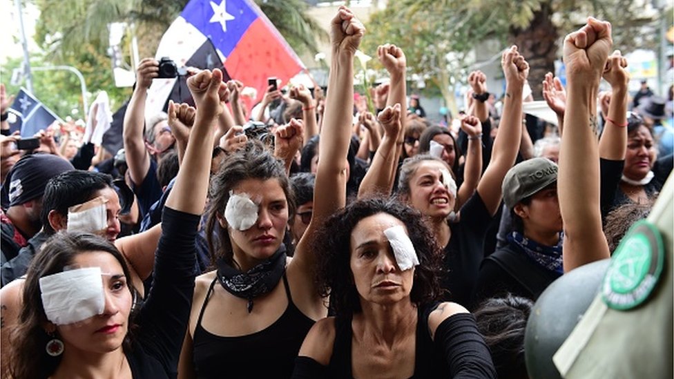 Un nuevo informe de Amnistía Internacional, que realizó una investigación en el país sudamericano, acusa al gobierno chileno de lastimar deliberadamente a los manifestantes. Foto: Getty Images