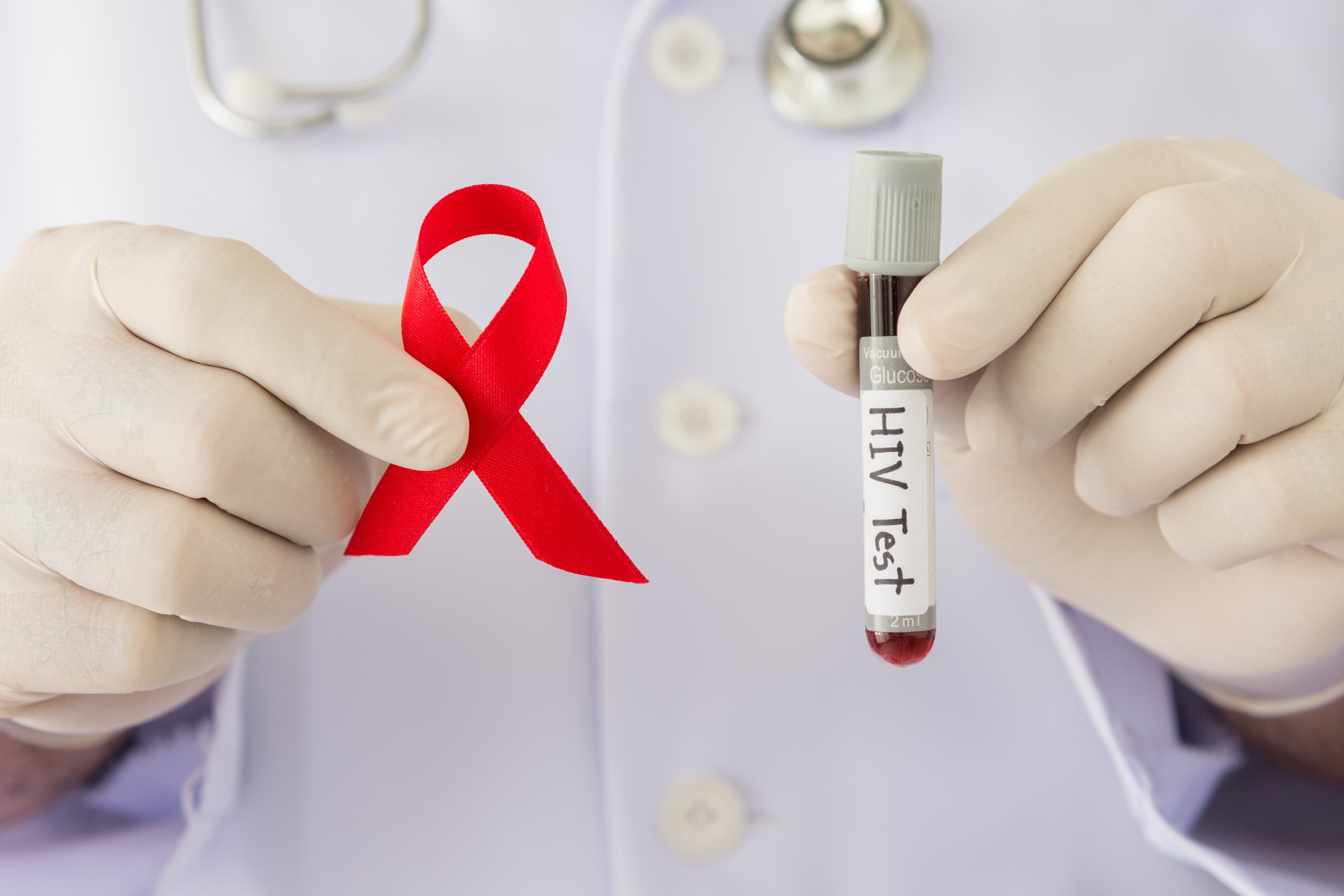 Todas las personas, al iniciar su actividad sexual, deben hacerse regularmente la prueba de VIH, especialmente si pertenecen al grupo de población en riesgo. (Foto Prensa Libre: Shutterstock)