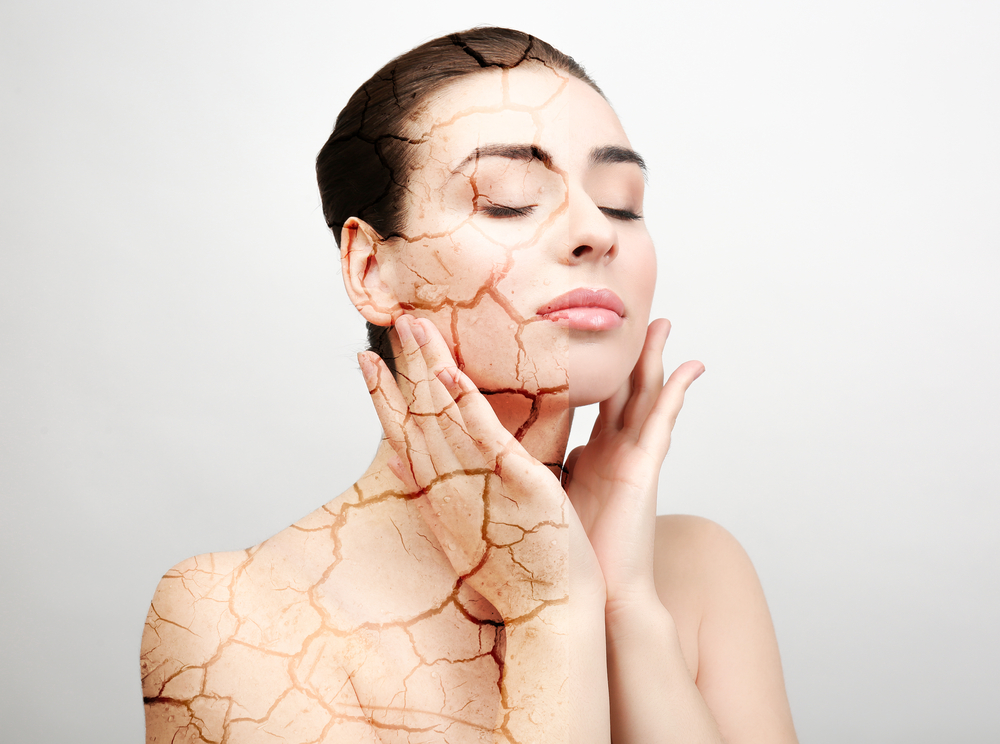 La piel seca surge debido a la deshidratación de las capas externas de la piel. (Foto Prensa Libre: Shutterstock)