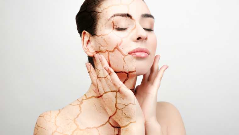 La piel seca surge debido a la deshidratación de las capas externas de la piel. (Foto Prensa Libre: Servicios).