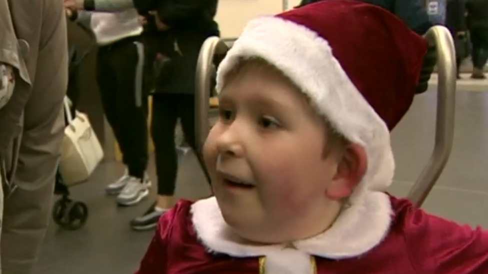 Noah nació con solo el 2% del cerebro. (Foto Prensa Libre: BBC)