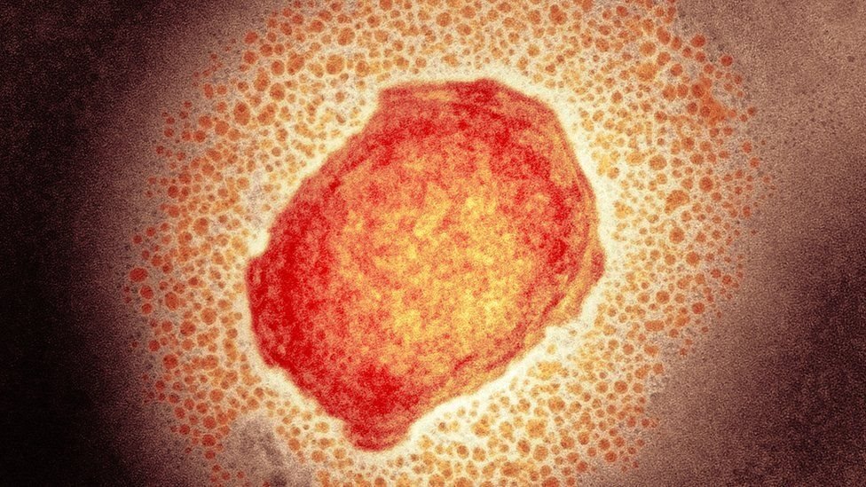 La viruela de los monos, también llamada viruela del simio o símica, es causada por un virus similar al de la viruela humana. (Foto Prensa Libre: Science Photo Library- BBC)