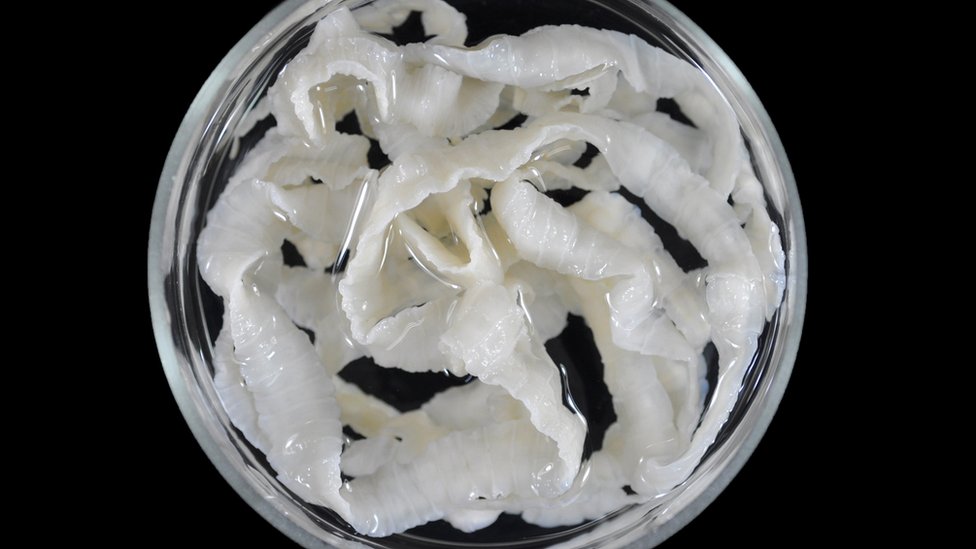 El Taenia solium es un parásito intestinal presente en todo el mundo, pero es más común en países donde se consume carne de cerdo. (Foto Prensa Libre: BBC Mundo Salud)