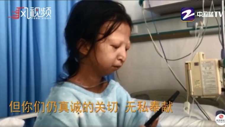 Cuando Wu Huayan fue internada en el hospital, pesaba poco más de 20 kilos. FENG VIDEO