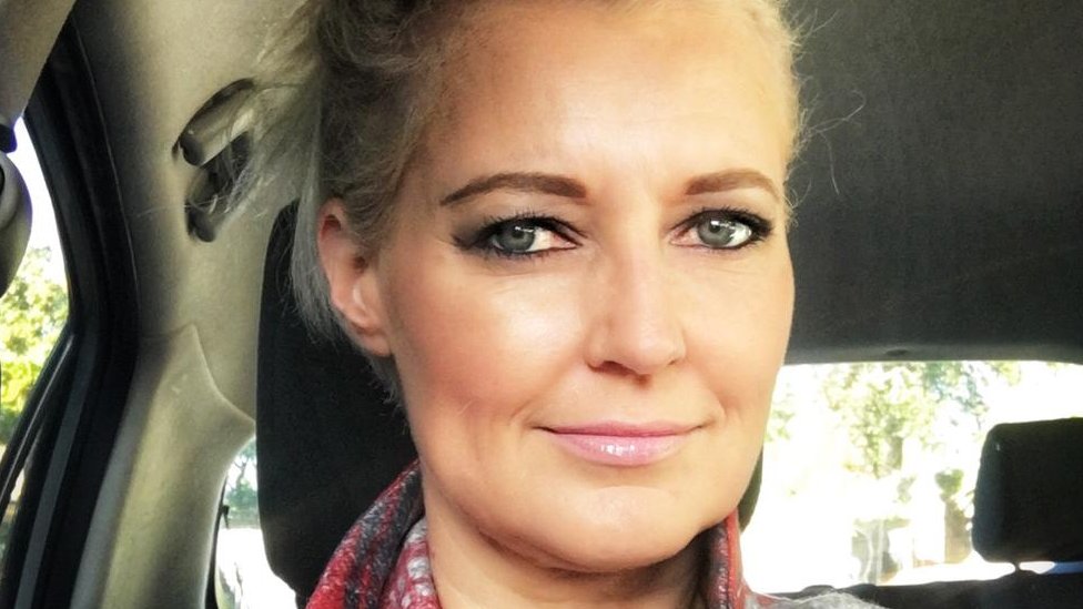 Kerry Van Der Merwe sufre de pecho hendido y quiere crear conciencia sobre la condición. Kerry Van Der Merwe