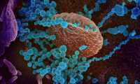 USA9867. ATLANTA (GA, EEUU), 25/02/2020.- Fotografía cedida por el Instituto Nacional de Alergias y Enfermedades Infecciosas (NIAID) y los Laboratorios Rocky Mountain (RML) por vía de los Institutos Nacionales de Salud (NIH) de una imagen de microscopio electrónico que muestra (objetos en azul) al SARS-CoV-2, el virus que causa el brote del coronavirus COVID-19, emergiendo de la superficie de las células cultivadas en el laboratorio (El virus que se muestra fue aislado de un paciente en los EE. UU.). Los Centros de Control y Prevención de Enfermedades (CDC) aseguraron este martes que el coronavirus COVID-19 se propagará por Estados Unidos y que las familias del país deben prepararse para una pérdida de ingresos y cambios en la vida cotidiana. EFE/ NIAID-RML /SOLO USO EDITORIAL /NO VENTAS