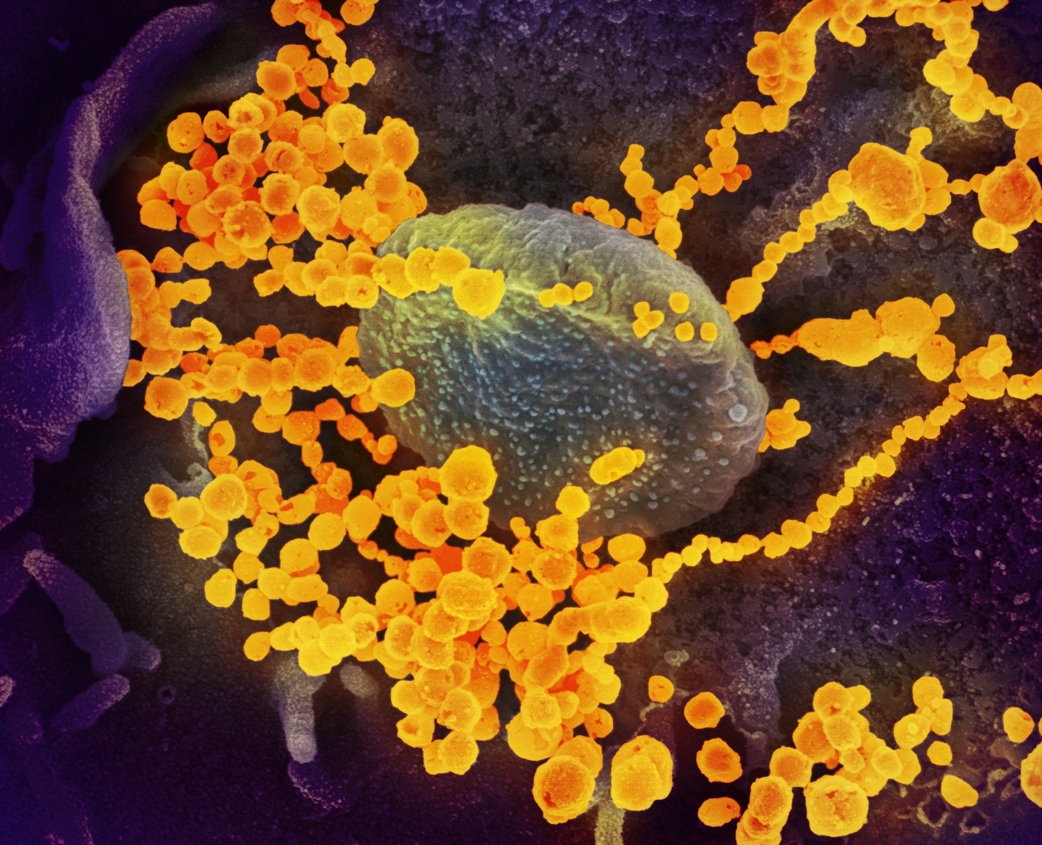 El coronavirus se cobra la primera víctima en EE. UU. (Foto Prensa Libre: EFE)