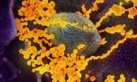 USA9865. ATLANTA (GA, EEUU), 25/02/2020.- Fotografía cedida por el Instituto Nacional de Alergias y Enfermedades Infecciosas (NIAID) y los Laboratorios Rocky Mountain (RML) por vía de los Institutos Nacionales de Salud (NIH) de una imagen de microscopio electrónico que muestra (objetos en amarillo) al SARS-CoV-2, el virus que causa el brote del coronavirus COVID-19, emergiendo de la superficie de las células cultivadas en el laboratorio (El virus que se muestra fue aislado de un paciente en los EE. UU.). Los Centros de Control y Prevención de Enfermedades (CDC) aseguraron este martes que el coronavirus COVID-19 se propagará por Estados Unidos y que las familias del país deben prepararse para una pérdida de ingresos y cambios en la vida cotidiana. EFE/ NIAID-RML /SOLO USO EDITORIAL /NO VENTAS