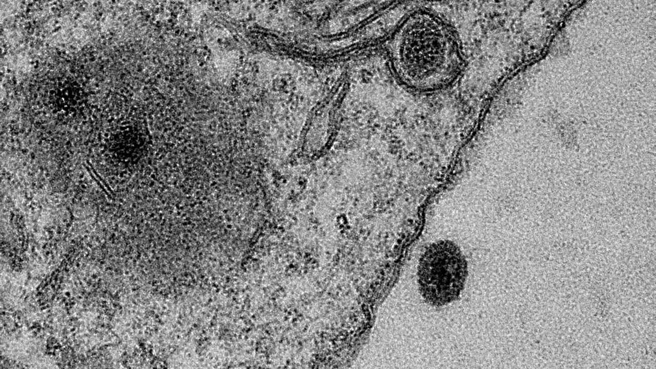 El Yaravirus fue descubierto en un lago urbano artificial en Brasil. (Foto Prensa Libre: Science Magazine)