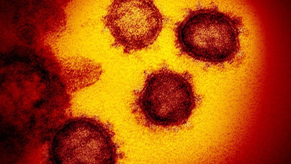 Según el último reporte de la OMS, emitido el domingo, había 87.000 personas contagiadas de coronavirus y alrededor de 2.800 muertes.
