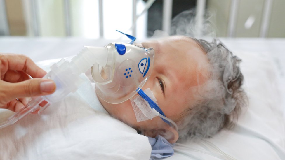 Virus respiratorio sincitial: la enfermedad respiratoria que preocupa a los pediatras (y no es el coronavirus)