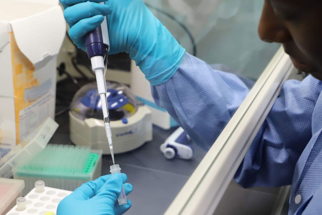 Muchos países ya cuentan con pruebas para detectar casos de coronavirus. (Foto Prensa Libre: Tomada de Noticias ONU). 