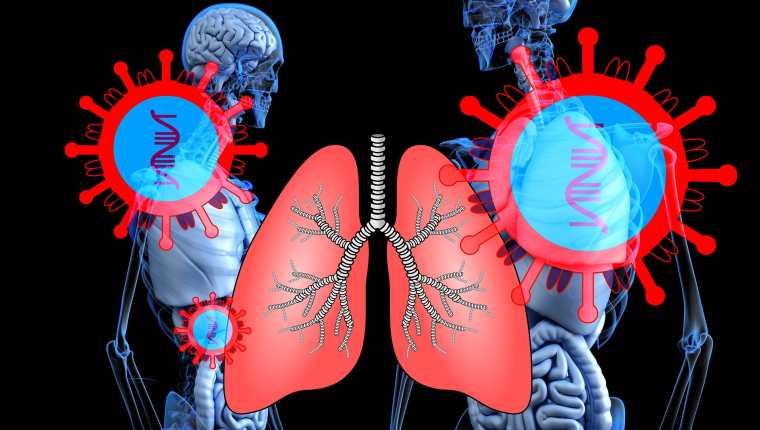 Un sistema respiratorio fortalecido ayudará a enfrentar al covid-19 de mejor manera. (Foto Prensa Libre: Pixabay)