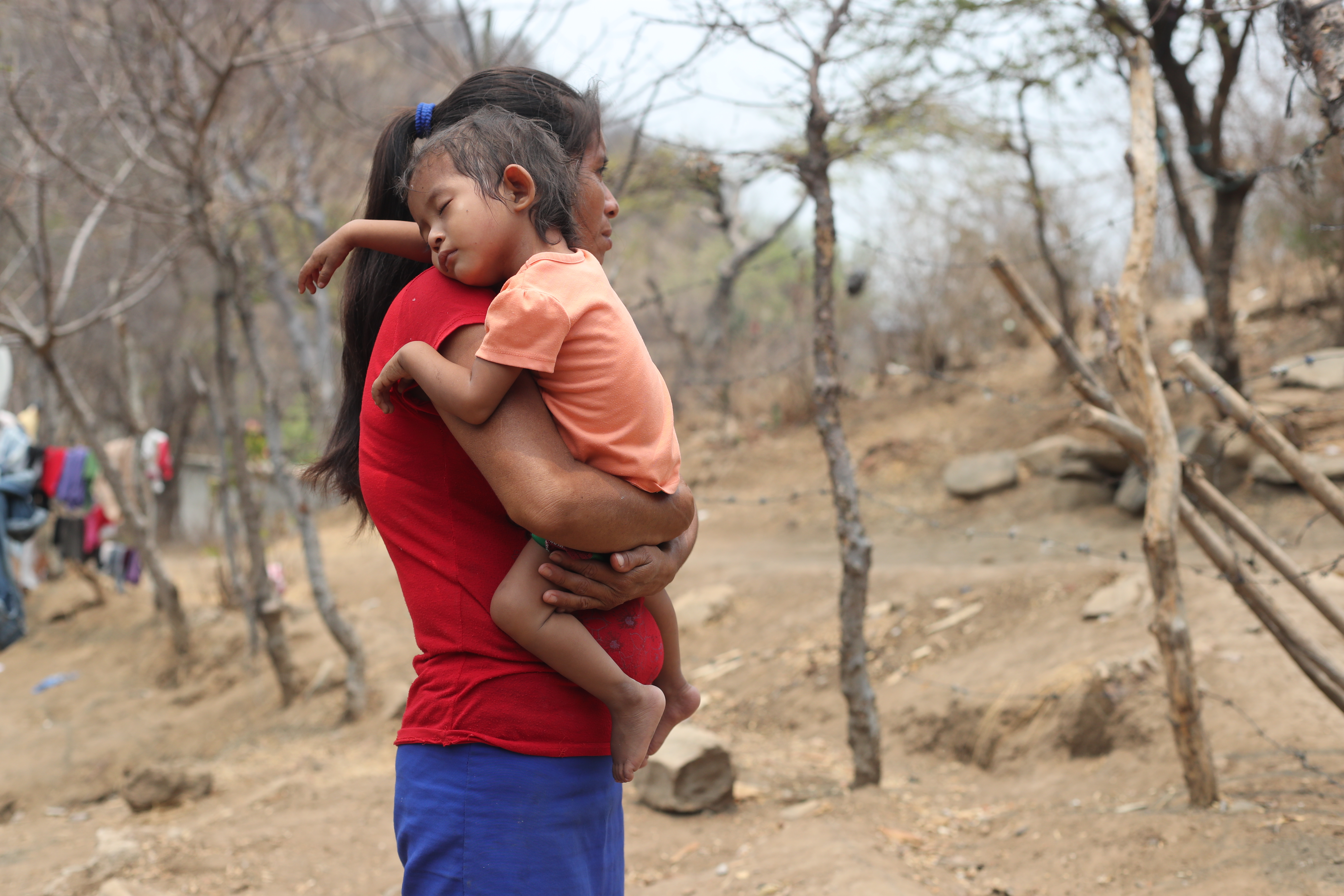 Gisele está por cumplir los dos años sufre de desnutrición aguda. Su condición la hace propensa a enfermarse. Los médicos recién le diagnosticaron neumonía y fue necesario hospitalizada. La pequeña es originaria del municipio de Zacapa, donde hay otros 33 niños con desnutrición aguda. (Foto Prensa Libre: Érick Ávila)
