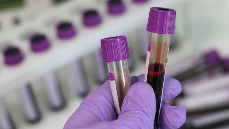 Estudio realizado en China indica que personas con sangre de tipo A podrían ser más propensas a contagiarse de covid-19. (Foto Prensa Libre: Pixabay).