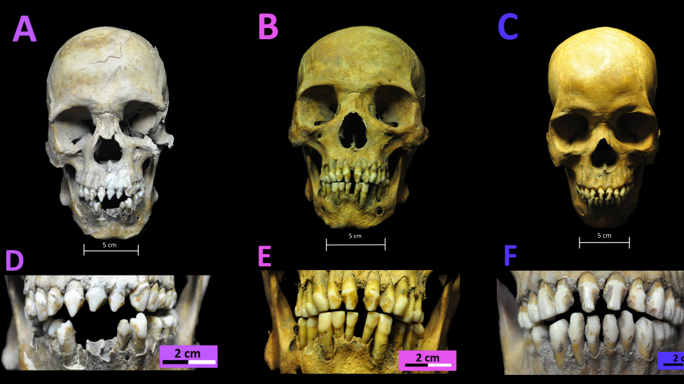 Los esqueletos fueron localizados en una fosa común del siglo XVI. RODRIGO BARQUERA