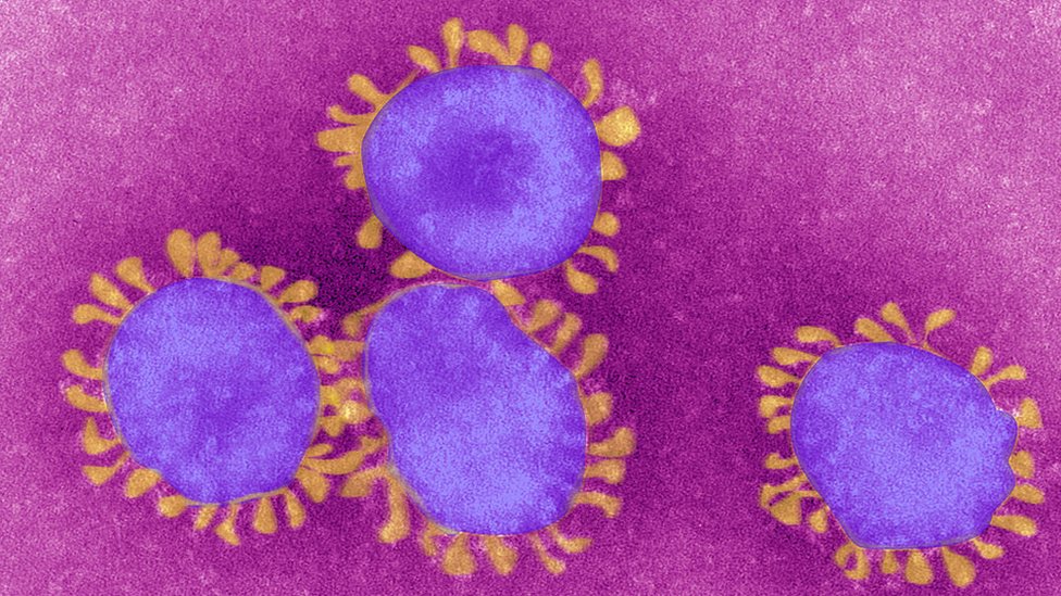 El SARS-CoV-2 ha sido catalogado como un virus con potencial endémico por la OMS. Getty Images