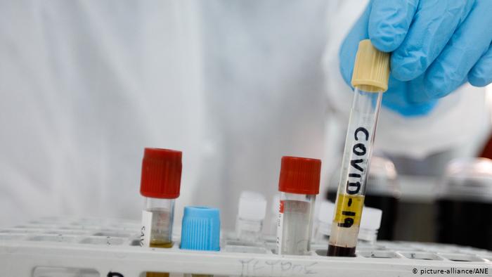 Instituto alemán prevé vacunación masiva contra la COVID-19 en “cuestión de meses”