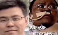 Hu Weifeng, uno de los médicos afectados por cambios en el color de la piel, murió en China. (Foto Prensa Libre: Hemeroteca PL) 