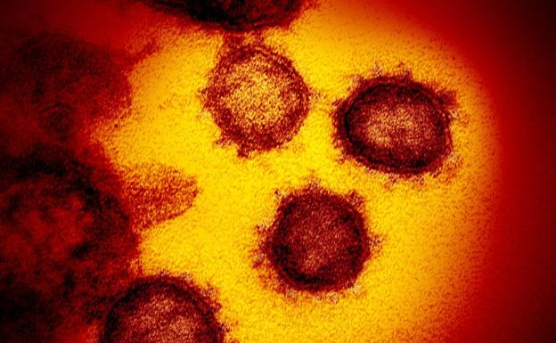 Microfotografía electrónica de barrido a color de una célula apoptótica muy infectada con partículas del virus del SARS-COV-2 (naranja), aislada de una muestra de un paciente. Imagen capturada en la Instalación de Investigación Integrada del NIAID (IRF) en Fort Detrick, Maryland.
NIAID / FLIKR, CC BY-SA