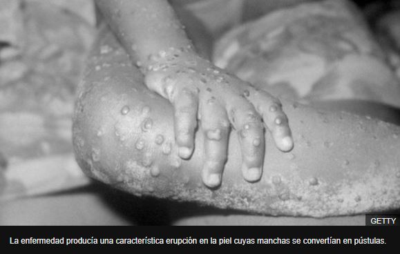 (Foto Prensa Libre: BBC)