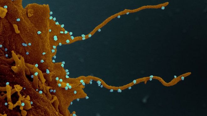 La célula infectada, siguiendo las instucciones del virus (en azul), desarrolla largos tentáculos para infectar otras células. (ELIZABETH FISCHER, MICROSCOPY UNIT NIH/NIAID)