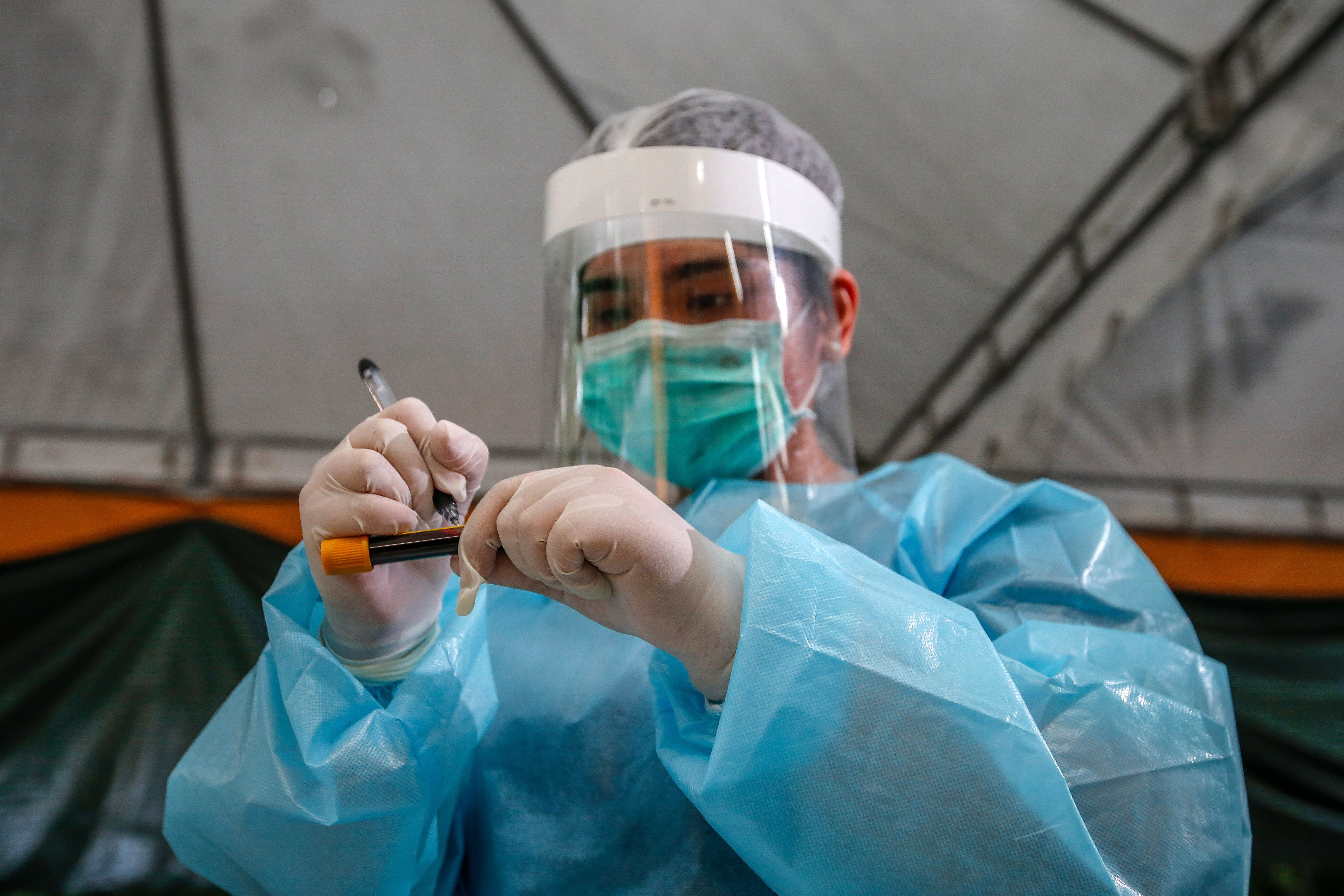 La investigación ofrece un recuento de los síntomas neurológicos de 43 personas (de 16 a 85 años), que eran casos confirmados o sospechosos de coronavirus. (Foto Prensa Libre: AFP)