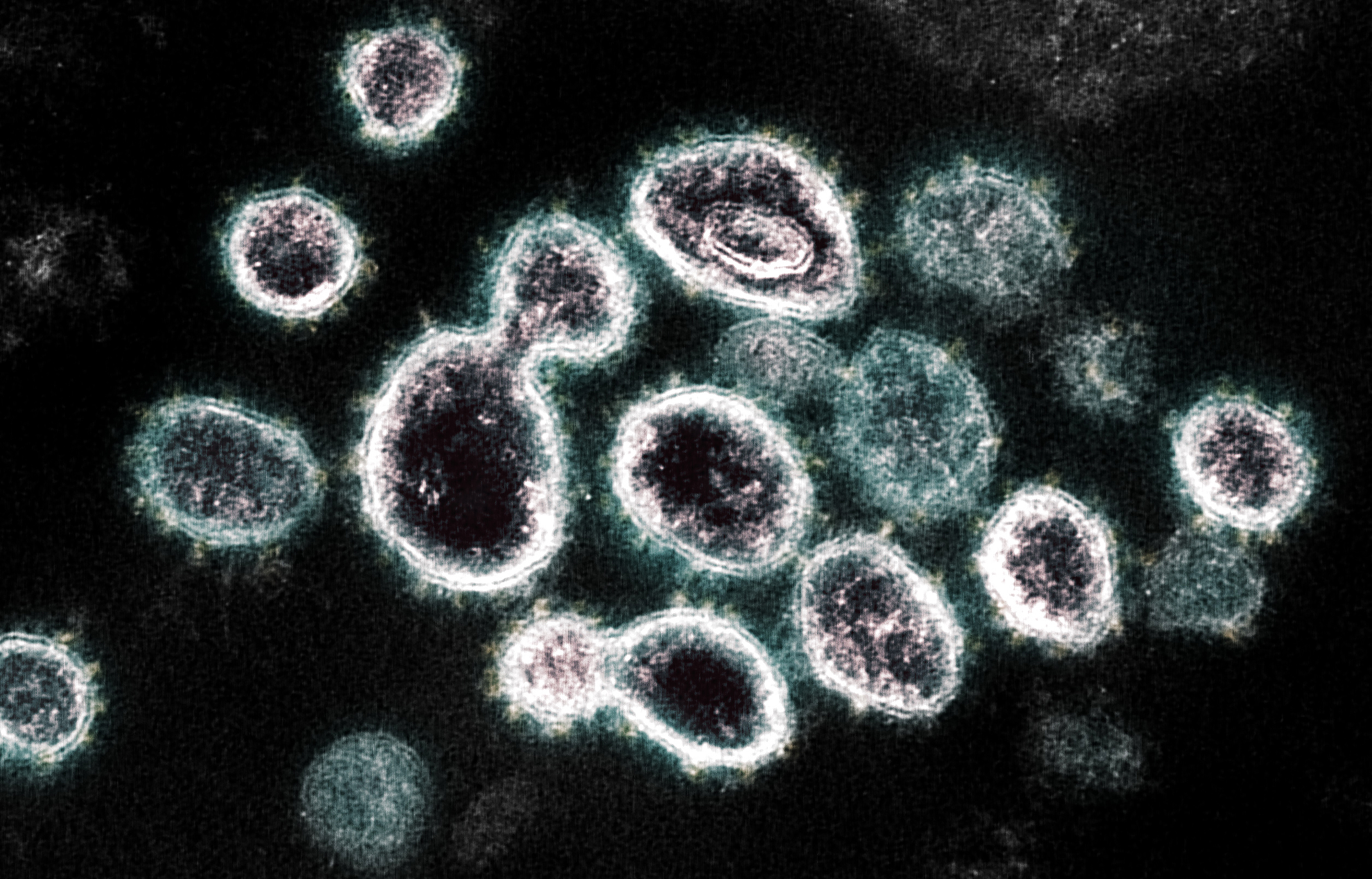 Imagen de un microscopio electrónico, proporcionada por el Instituto Nacional de Alergias y Enfermedades Infecciosas, que muestra el SARS-CoV-2, el virus que causa la COVID-19, aislado de un paciente en Estados Unidos. (Cortesía de NIAID para The New York Times)

