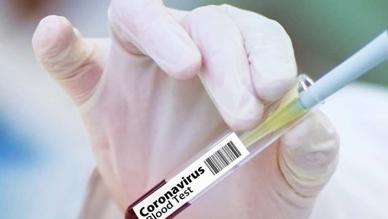 Varios proyectos se desarrollan actualmente para enfrentar al coronavirus. (Foto Prensa Libre: Pixabay)