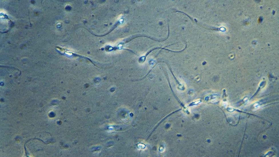 La interpretación del aleteo de los espermatozoides estaba basado en imágenes en dos dimensiones.