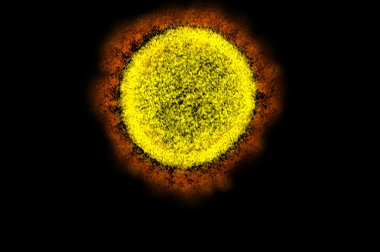 Microfotografía del virus SARS-CoV-2, aislada de un paciente. Imagen capturada y coloreada en el Centro de Investigación Integrada del NIAID (IRF) en Fort Detrick, Maryland, el 12 de marzo de 2020.
NIAID / Flickr, CC BY-SA