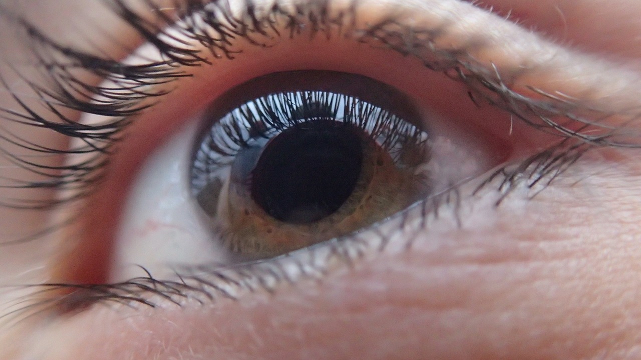 El glaucoma es la tercera causa de ceguera en el mundo. (Foto Prensa Libre: Pixabay)
