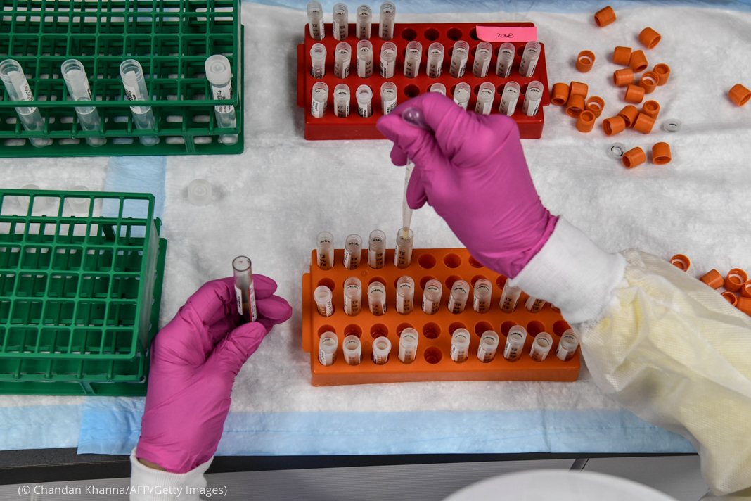A lab technician sorts blood samples for COVID-19 vaccination study at the Research Centers of America in Hollywood, Florida on August 13, 2020. (Photo by CHANDAN KHANNA / AFP) (Photo by CHANDAN KHANNA/AFP via Getty Images)