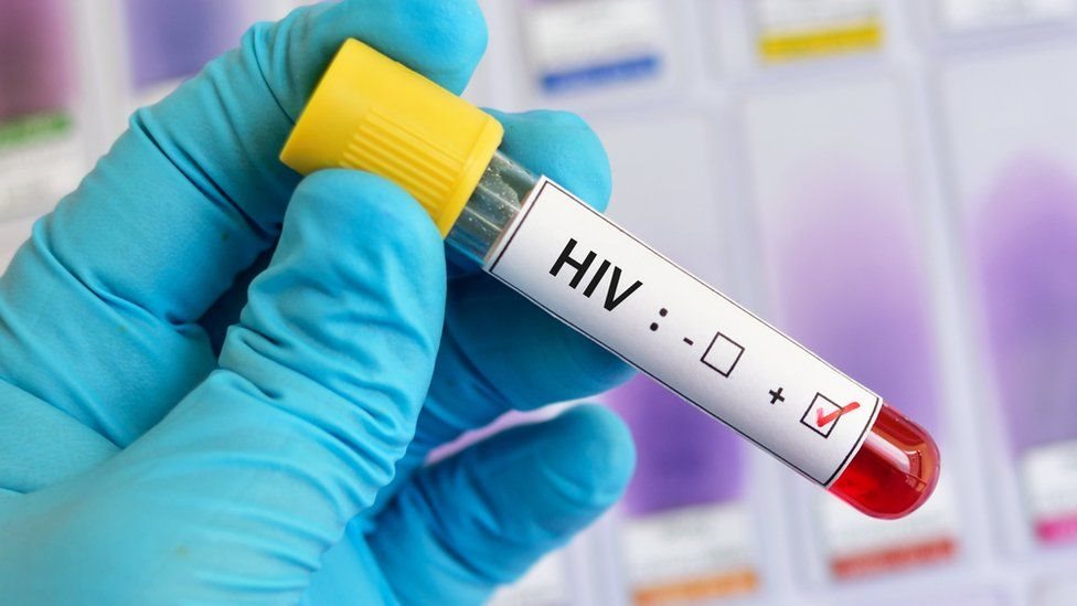 Cada año millones de personas en el mundo se contagian de VIH.