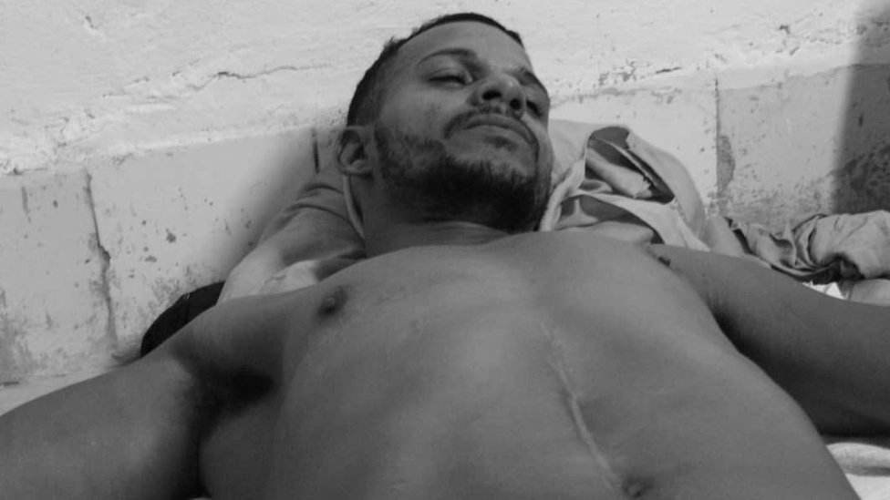 Maykel Castillo es uno de los miembros del Movimiento que se puso en huelga de hambre y sed hace una semana. (Foto Prensa Libre: Katherine Bisquet)