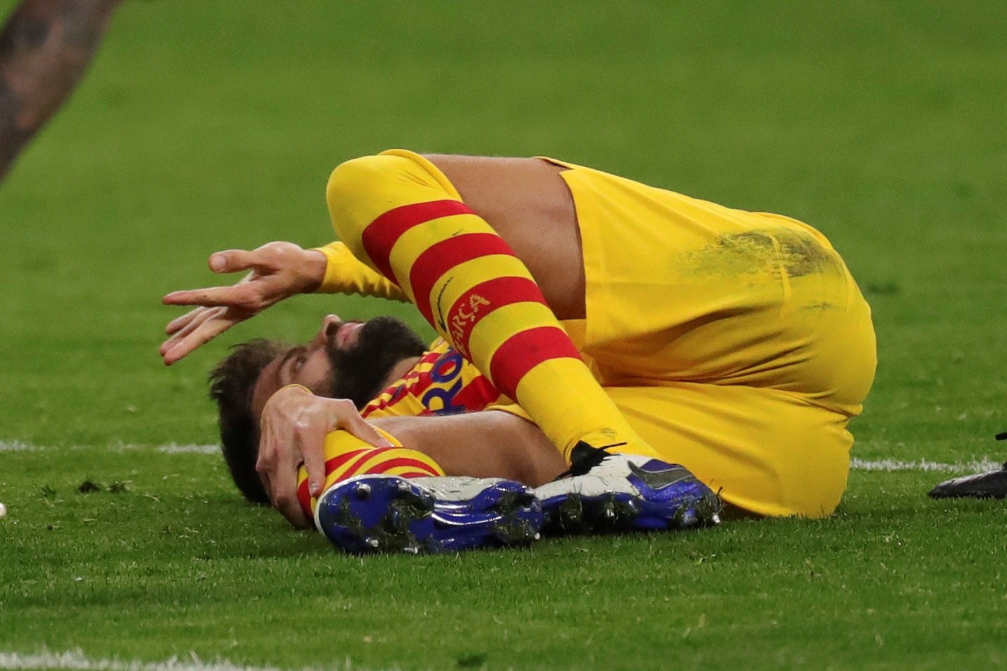 Gerard Piqué tiene un esguince de grado 3 en el ligamento lateral interno y lesión parcial del ligamento cruzado anterior de la rodilla derecha. (Foto Prensa libre: EFE)