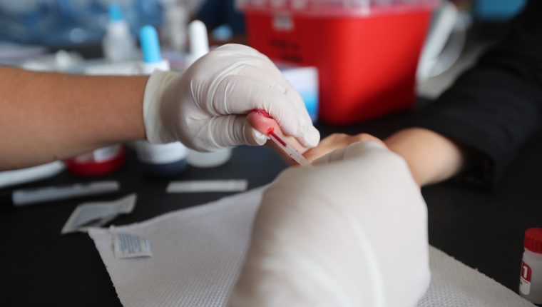 Durante la pandemia del covid-19 las pruebas para detectar nuevos casos con VIH han disminuido. (Foto Prensa Libre: Hemeroteca PL)