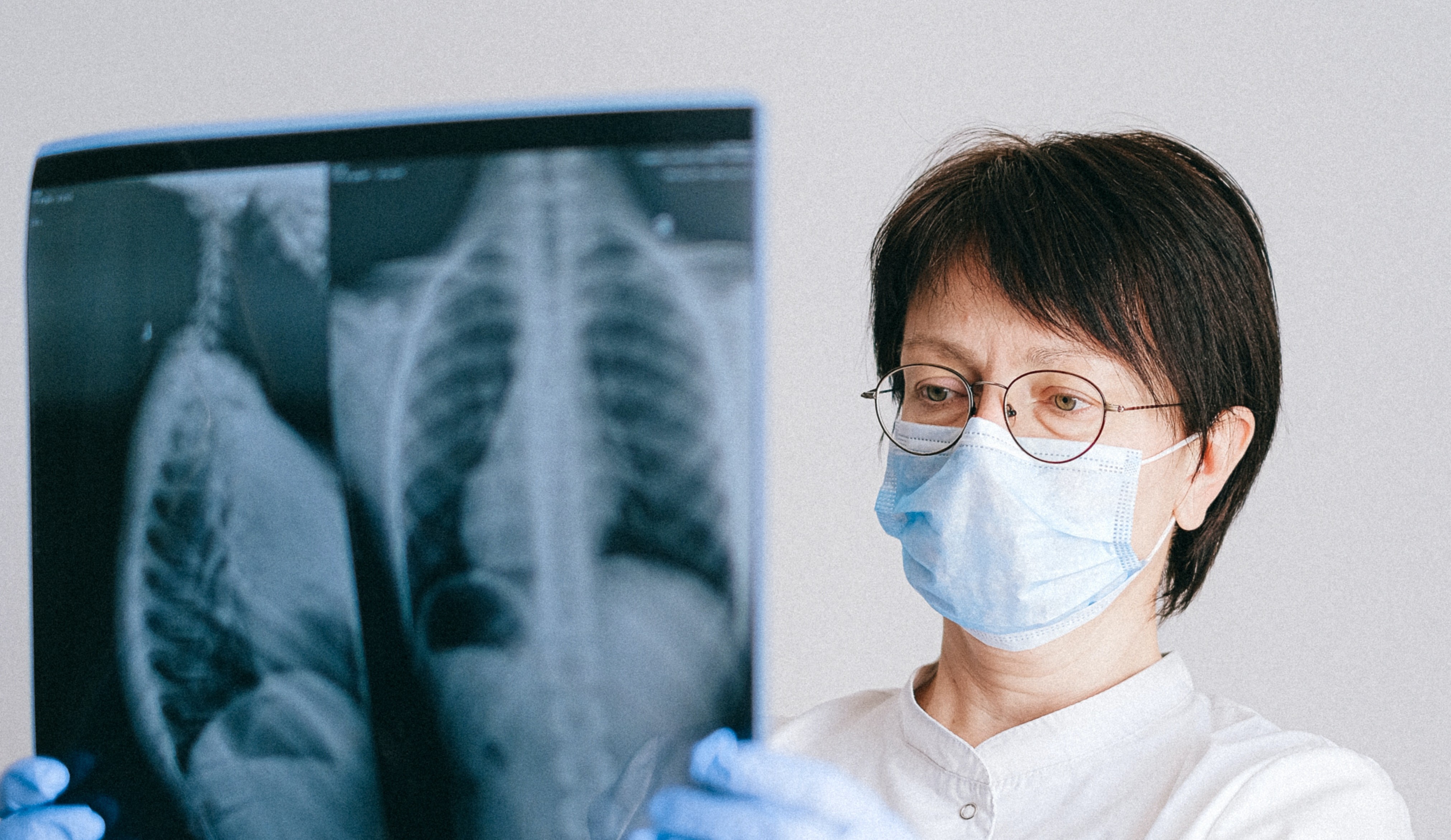 La ciencia busca soluciones para apoyar a  los pacientes con cáncer de pulmón avanzado.  (Foto Prensa Libre: Anna Shvets/Pexels)
