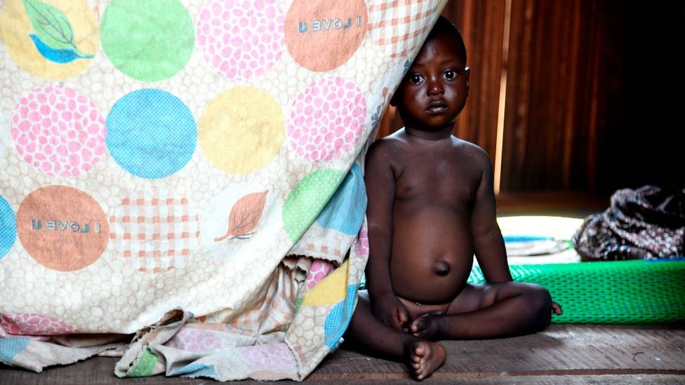 Sobrevivir más allá de la infancia es mucho más difícil en África que en Europa. (Foto Prensa Libre: Getty Images)