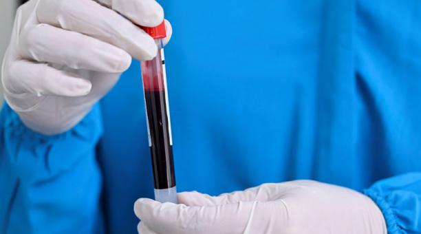 El extraño virus infecta el torrente sanguíneo. (Foto referencial: AFP)