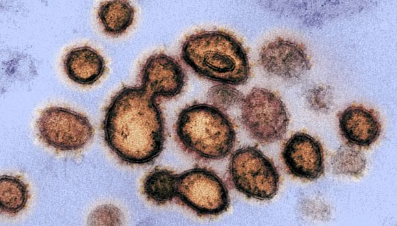 Identifican en Brasil una nueva cepa del coronavirus – Prensa Libre