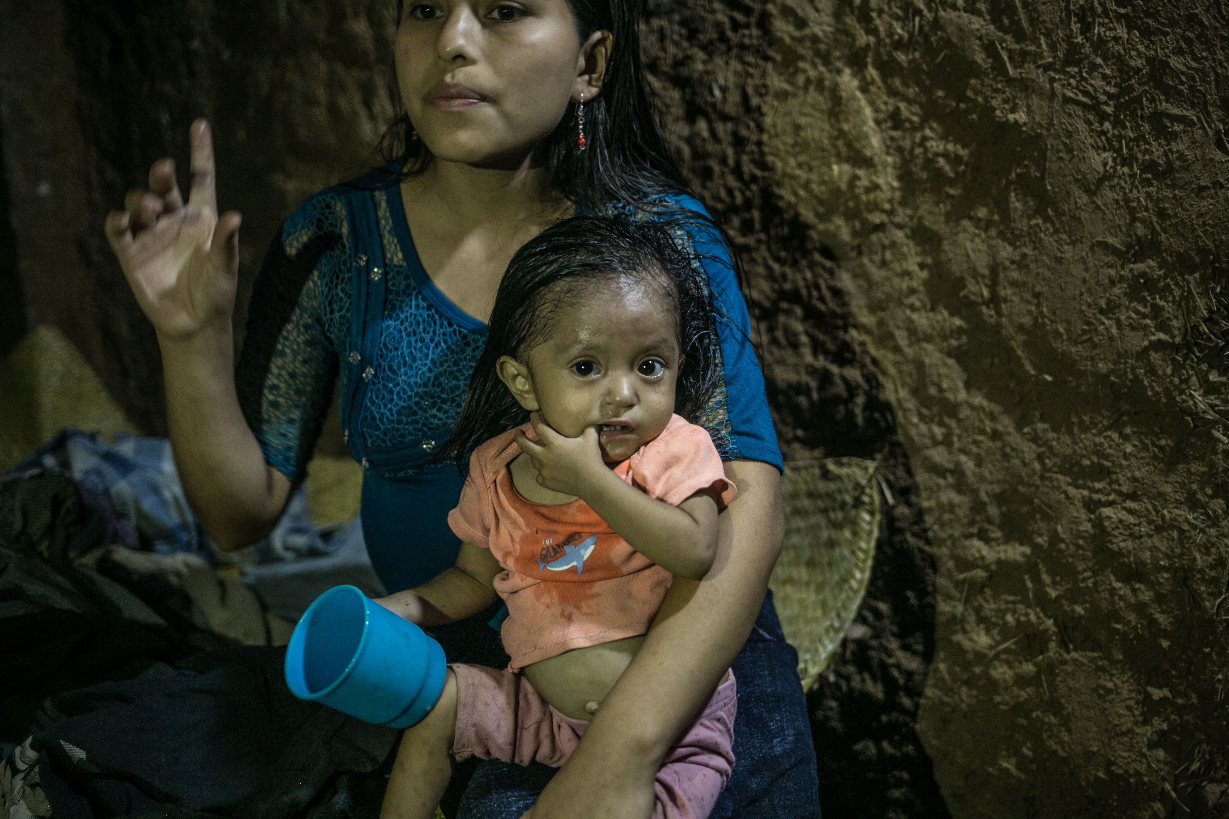 ACOMPAÑA CRÓNICA: GUATEMALA DESNUTRICIÓN - AME8935. LA PALMILLA (GUATEMALA), 12/01/2021.- Fotografía del 24 de octubre de 2020 que muestra a la pequeña niña Yesmin mientras es cargada por su madre en su vivienda en La Palmilla, Chiquimula (Guatemala). Yesmin murió este lunes de madrugada. Con sólo 2 años de edad, una neumonía originada por la desnutrición acabó con su vida en el este de Guatemala. Durante las últimas semanas luchó por subir de peso, pero las secuelas de su nacimiento prematuro, su mala alimentación y las condiciones de su hogar la debilitaron. El caso de desnutrición de Yesmin, uno más de los cientos que cada año se registran en Guatemala, fue conocido en octubre pasado por Efe de la mano de la organización Antigua al Rescate, una entidad no gubernamental que asiste a familias en riesgo alimentario y que intentó hasta los últimos esfuerzos apoyar a la niña de dos años. EFE/ Esteban Biba ARCHIVO