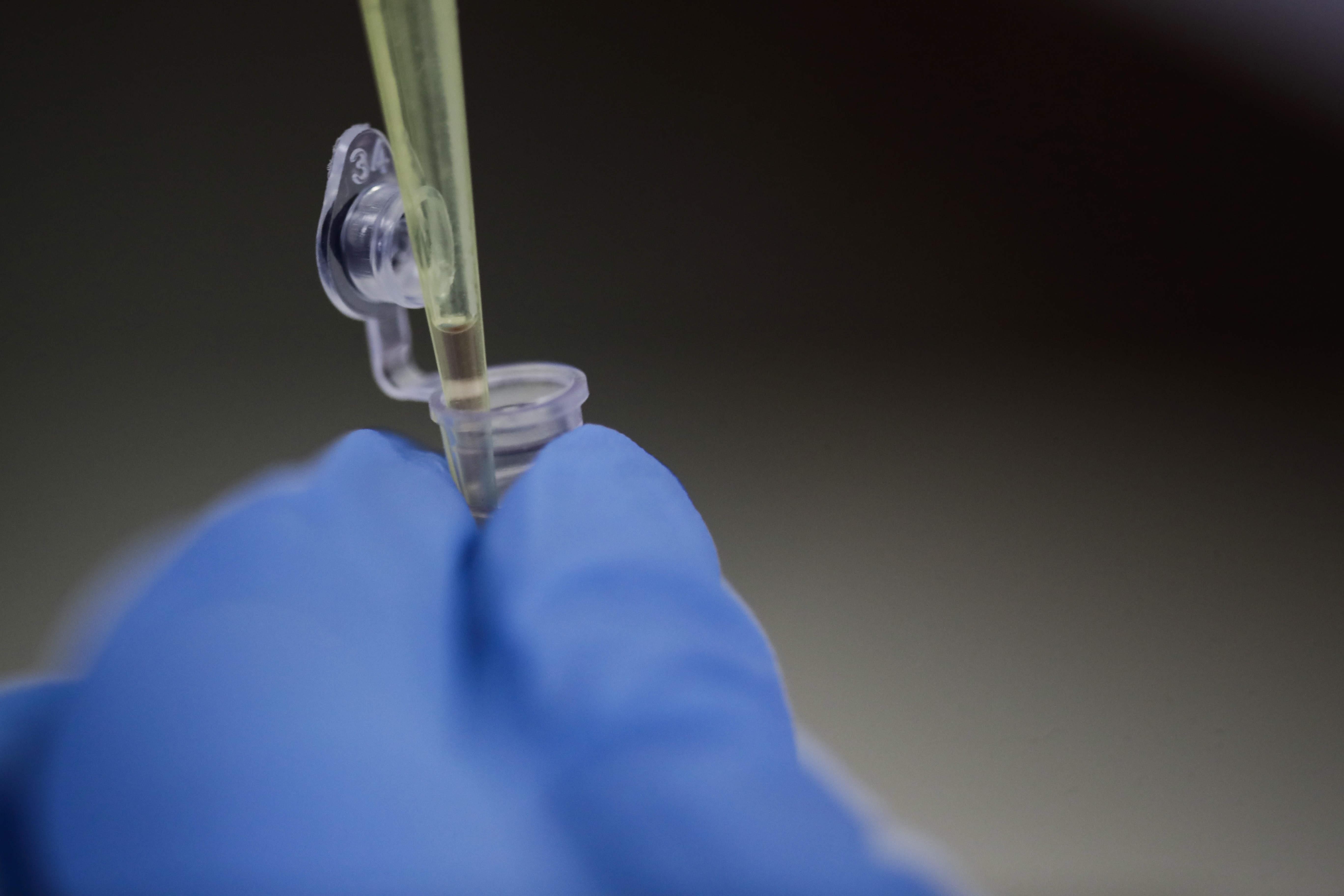Detalle de frascos con muestras de laboratorio el 25 de enero de 2021, en San José (Costa Rica), donde científicos desarrollan una prueba de saliva para detectar rápidamente el covid-19. (Foto Prensa Libre: EFE/ Jeffrey Arguedas)