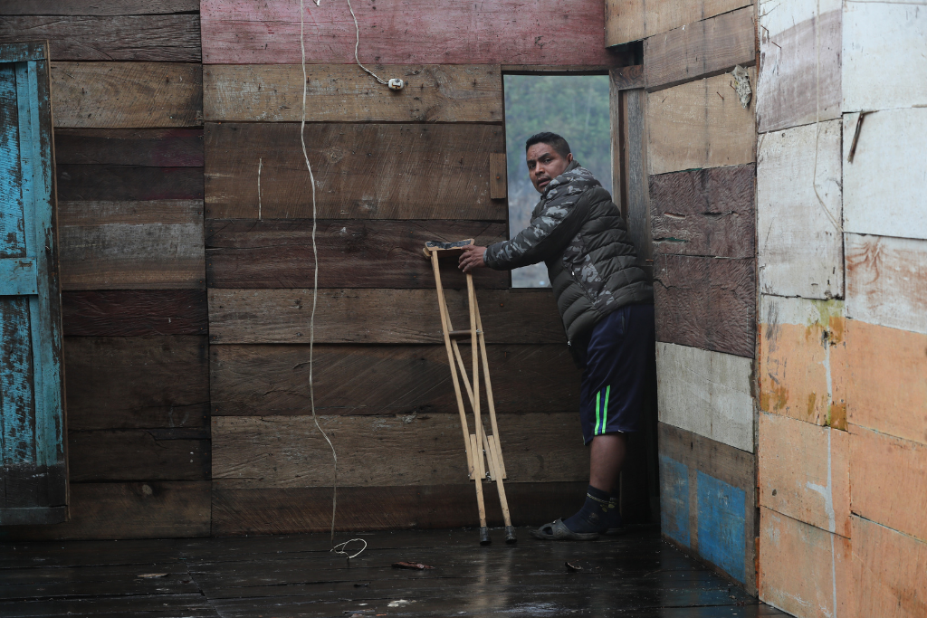 Gerardo Coc muestra los daños causados en su vivienda. Sin un lugar donde vivir y con una pierna fracturada, espera la ayuda para subsistir. Foto: Érick Ávila