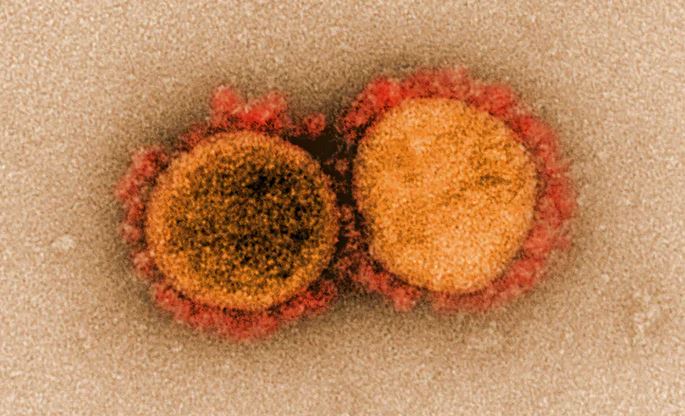 Micrografía del nuevo coronavirus SARS-CoV-2 tomada en marzo de 2020.