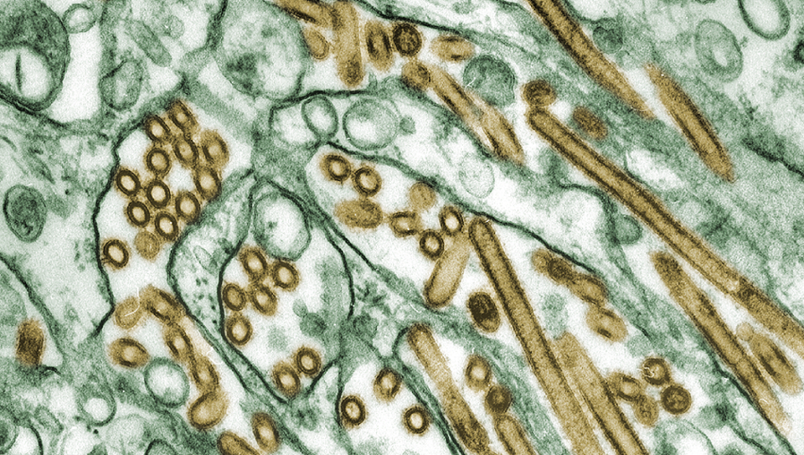 Los virus de la familia Orthomyxoviridae son los causantes de la gripe en los vertebrados, humanos incluidos. En esta microfotografía se muestra el virus H5N1 de gripe aviar (en amarillo) atacando células.
Wikimedia Commons / Centers for Disease Control and Prevention