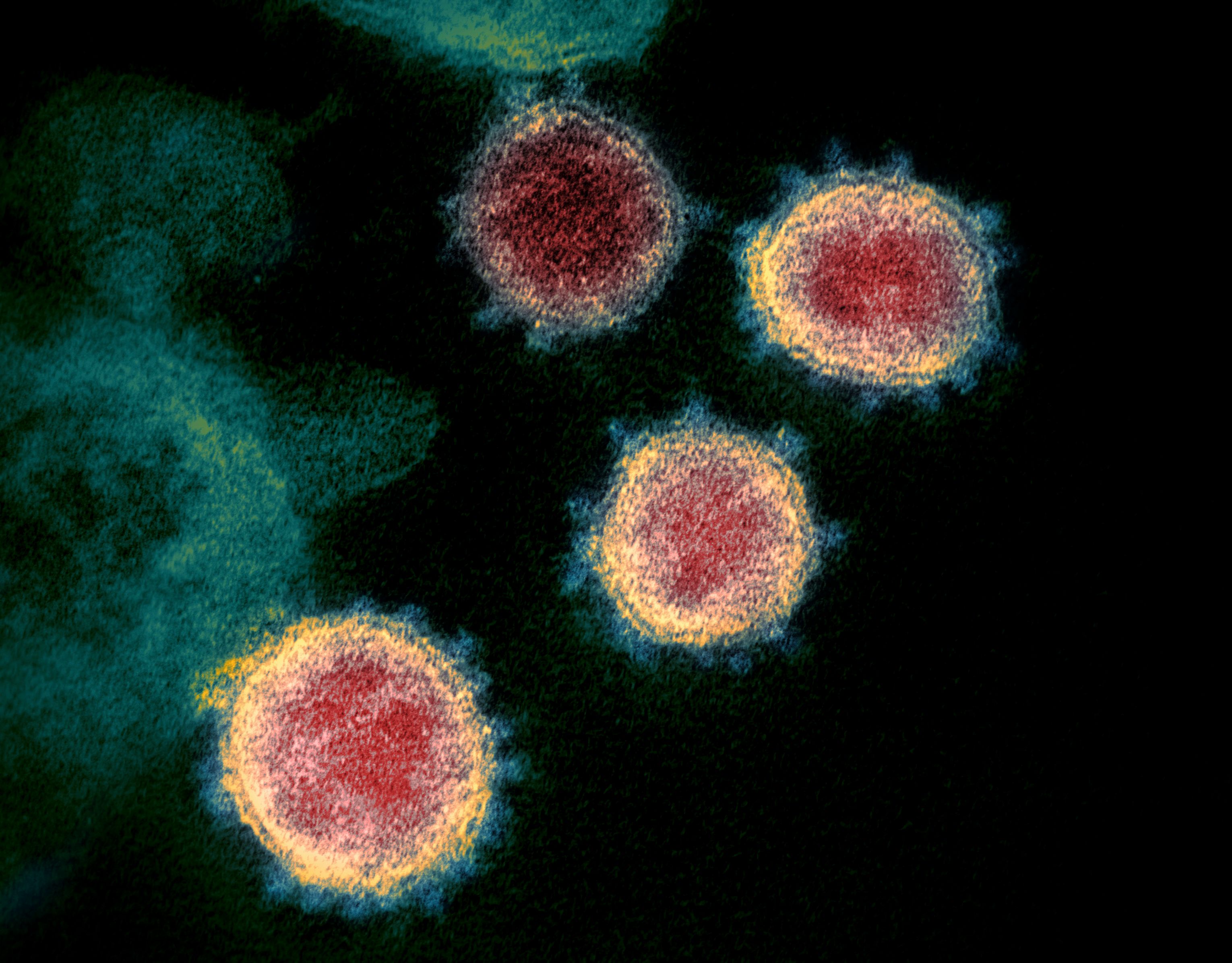 Una nueva variante del coronavirus causa preocupación. (Foto Prensa Libre: AFP)